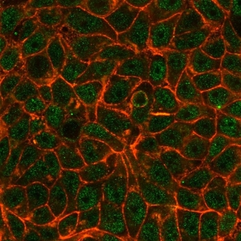 TIF1 alpha Antibody / TIF1A / TRIM24