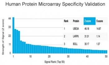 Ubiquitin-protein ligase E3A Antibody / UBE3A