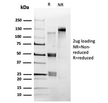 POLE3 Antibody / CHRAC17