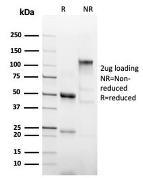 Recombinant Poly His Antibody / His Tag