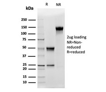 CD5L Antibody / CD5 Ligand