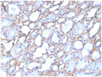 Collagen IV Antibody / COL4A1/2