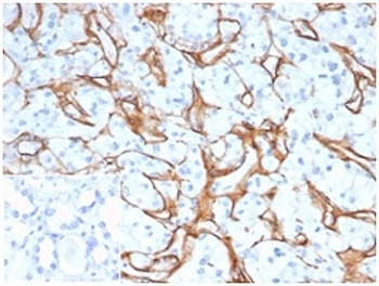 Collagen IV Antibody / COL4A1/2
