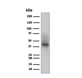 Recombinant CD38 Antibody