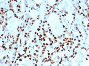 Recombinant CCNE1 Antibody / Cyclin E1