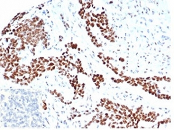 Recombinant WT1 Antibody / Wilms Tumor 1