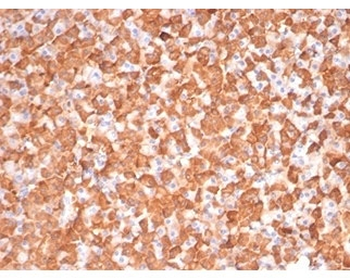 PRKCI Antibody / PKC iota