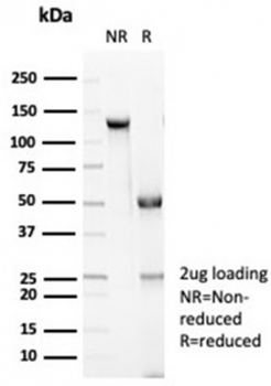 Recombinant CDH1 Antibody / E-Cadherin
