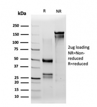 IRF3 Antibody / Interferon regulatory factor 3