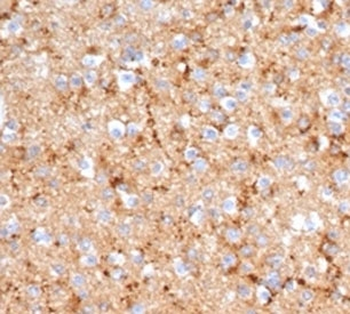 Recombinant SYP Antibody / Synaptophysin
