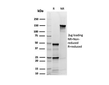 Recombinant SYP Antibody / Synaptophysin
