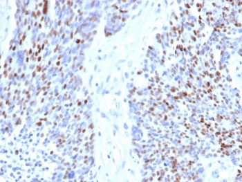 Recombinant Cyclin E1 Antibody / CCNE1