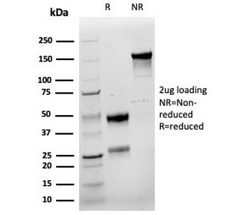 Recombinant Cyclin E1 Antibody / CCNE1