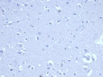 Recombinant CD8A Antibody