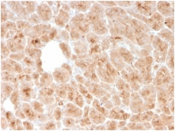 Recombinant LMO2 Antibody / Rhombotin 2