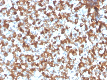 Recombinant FSH beta Antibody