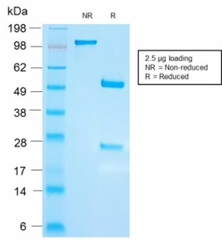 Recombinant FSH beta Antibody
