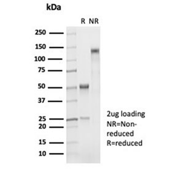 Recombinant Napsin A Antibody