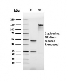 Recombinant PU.1 Antibody / SPI1
