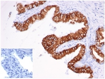 Recombinant EpCAM Antibody