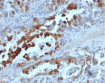 Recombinant Cytokeratin 20 Antibody / CK20