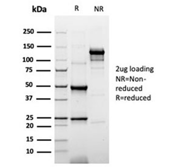 Recombinant Cytokeratin 20 Antibody / CK20