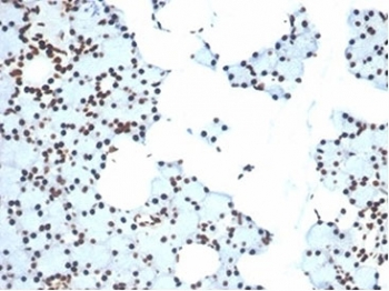 XRCC5/Ku80 Antibody