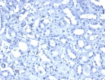 Recombinant Wilms Tumor 1 Antibody / WT1