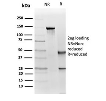 IGF1R Antibody / Insulin like growth factor 1 receptor