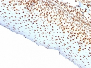 Recombinant Nuclear Antigen Antibody