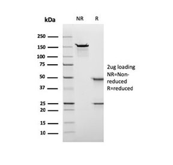 Recombinant Nuclear Antigen Antibody
