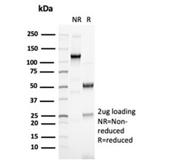Recombinant PAX6 Antibody