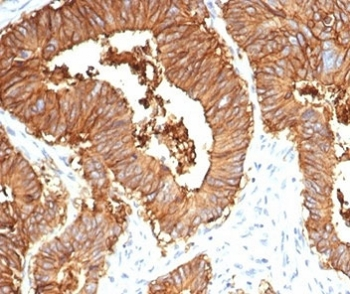 Recombinant EpCAM Antibody / Cytoplasmic domain