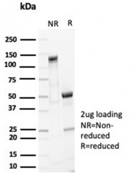 Recombinant EpCAM Antibody / Cytoplasmic domain
