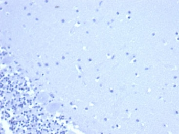 CD44 Antibody / HCAM