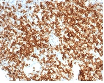 Recombinant CD6 Antibody