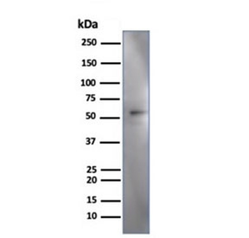 IRF3 Antibody / Interferon regulatory factor 3