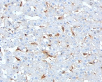 Complement C1q B-Chain Antibody / C1QB