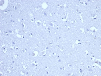 RRM1 Antibody / Ribonucleotide Reductase M1