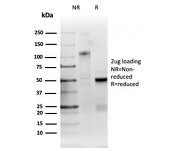 RRM1 Antibody / Ribonucleotide Reductase M1