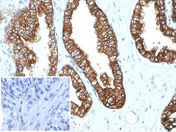 Recombinant Keratin 8/18 Antibody
