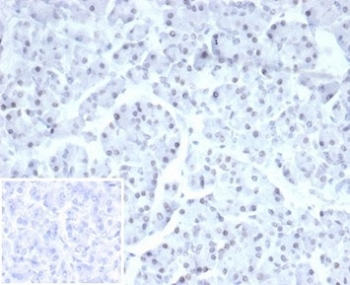 Recombinant PHOX2B Antibody