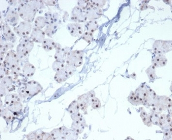 Recombinant PHOX2B Antibody
