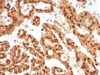 Recombinant STAT6 Antibody