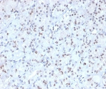 MGMT Antibody