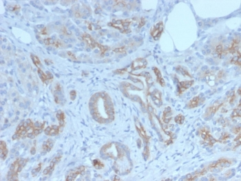 Golgi Glycoprotein 1 Antibody / GLG1