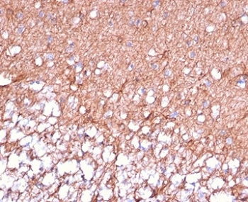 GFAP Antibody / Glial Fibrillary Acidic Protein