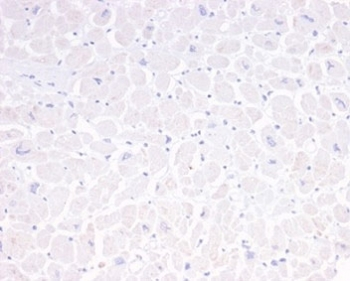 GFAP Antibody / Glial Fibrillary Acidic Protein