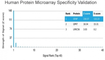 GFAP Antibody / Glial Fibrillary Acidic Protein