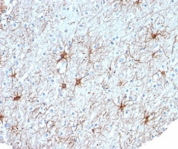 GFAP Antibody / Glial Fibrillary Acidic Protein